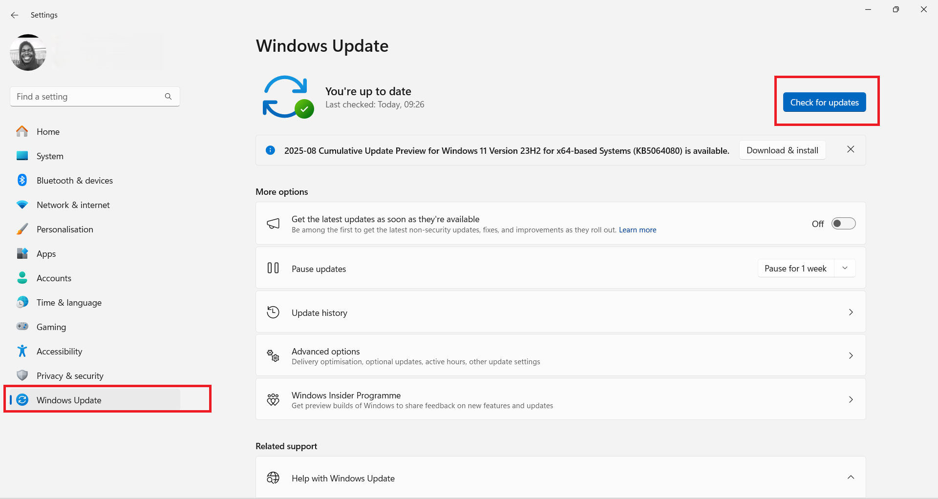 Click the Check for updates button